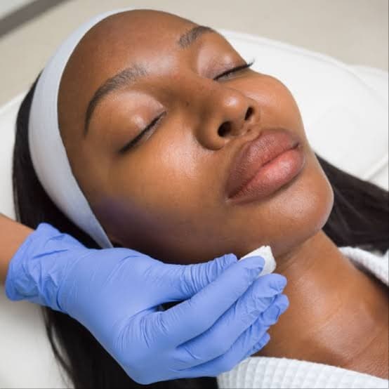 Chemical Peels at Radiant Glow Skin Spa in Beaumont, TX