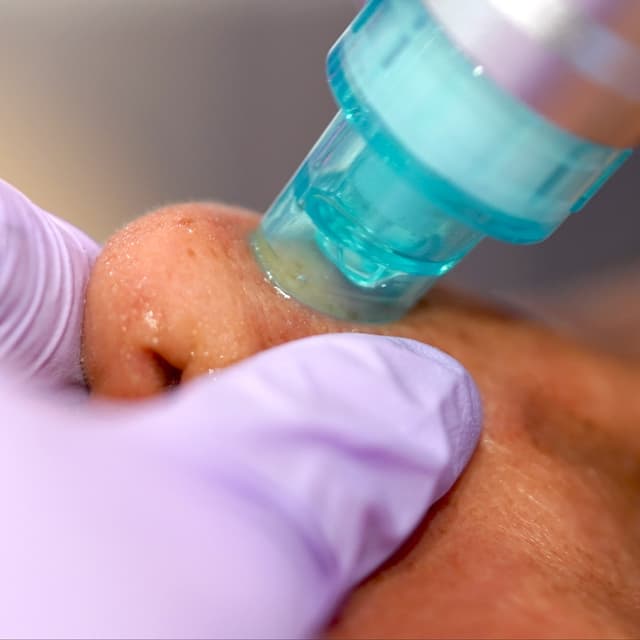 Hydodermabrassion at Radiant Glow Skin Spa in Beaumont, TX